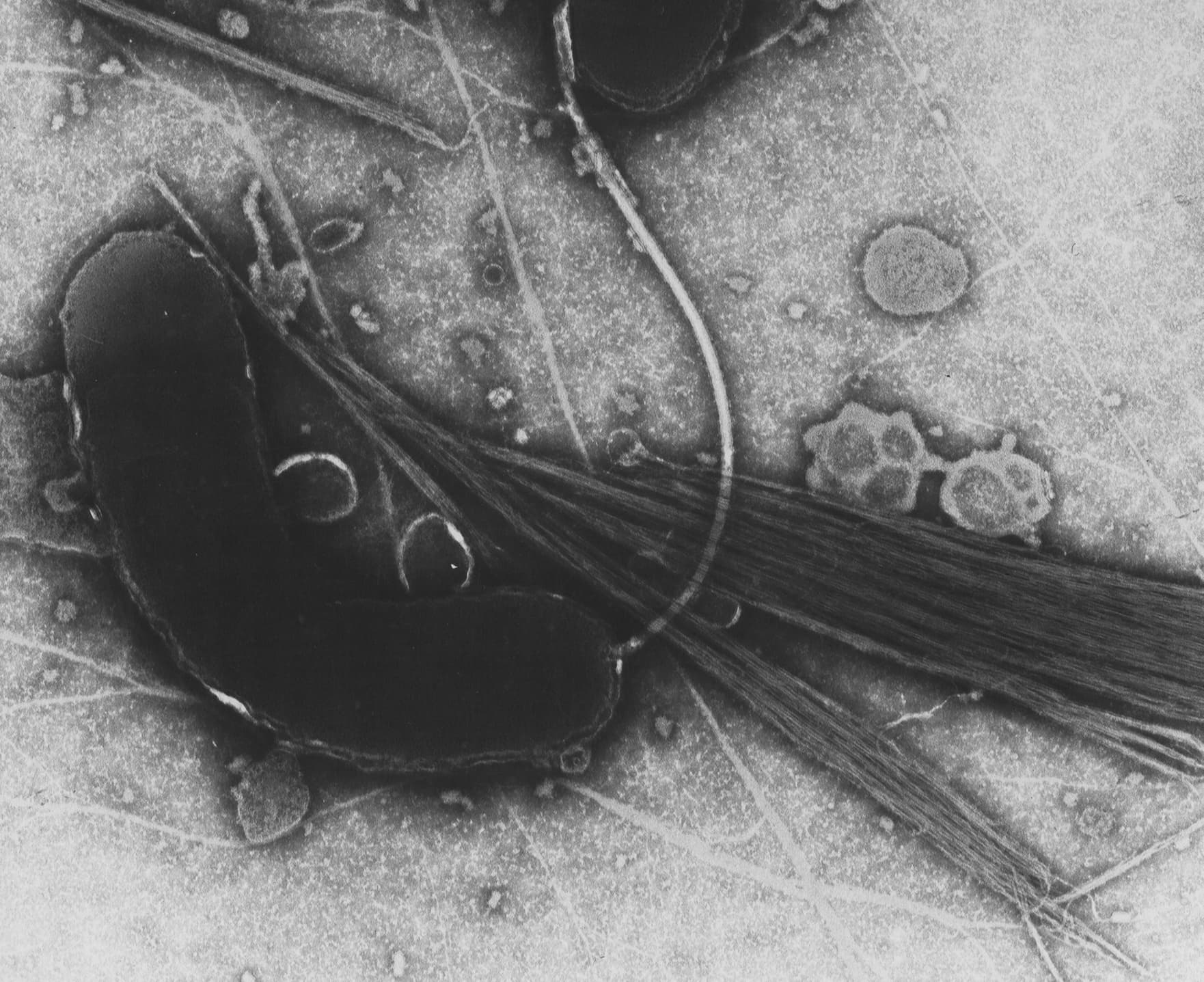 Электронная микрофотография изогнутой бактерии Vibrio cholerae с нитевидными пилями