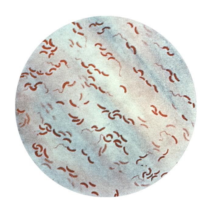 Окраска по Граму с запятовидными грамотрицательными бактериями Vibrio cholerae