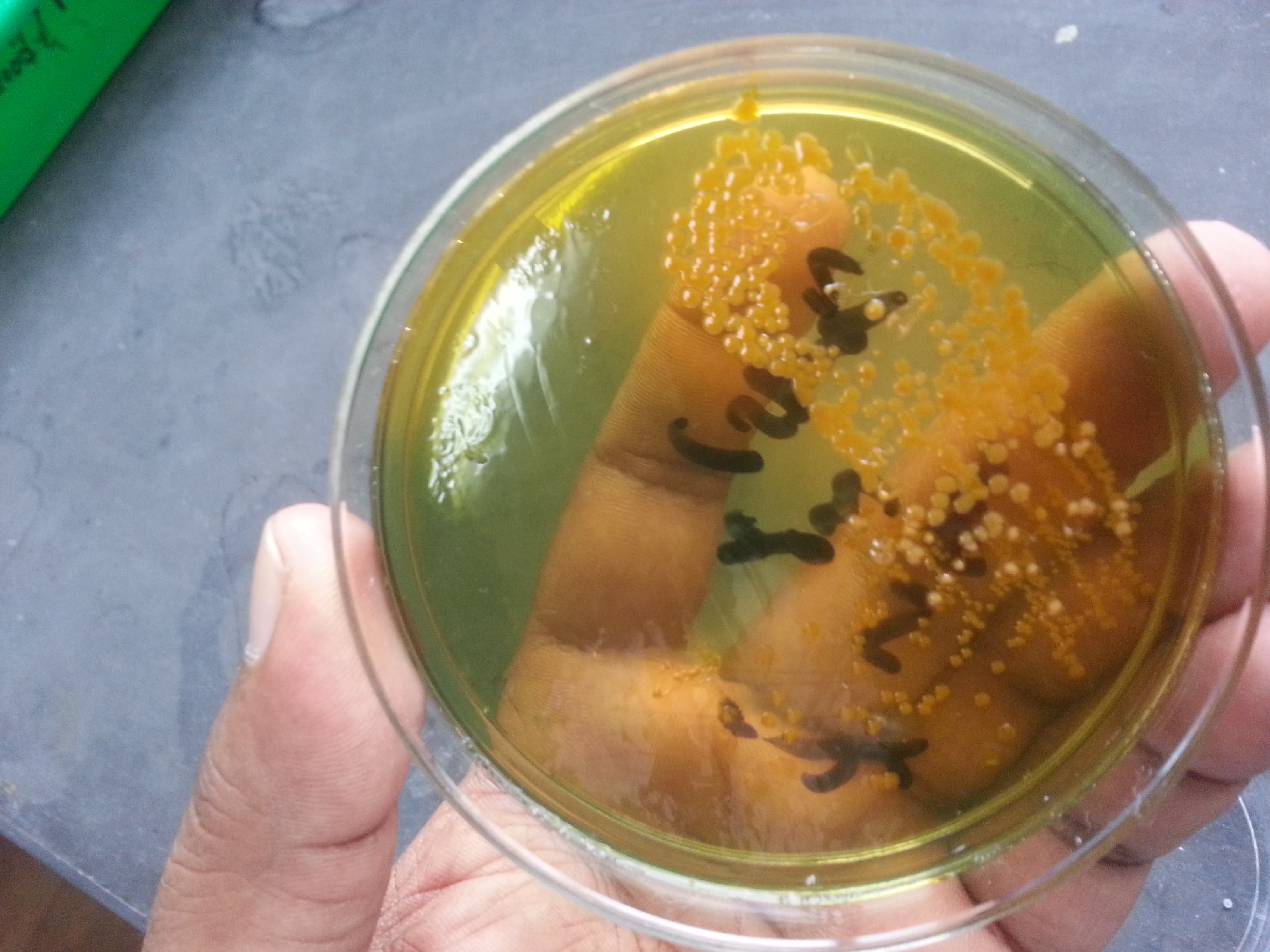 Чашка с агаром TCBS и жёлтыми колониями Vibrio cholerae из посева испражнений