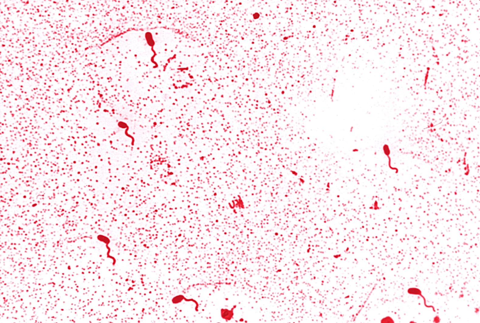 Микрофотография изогнутых грамотрицательных бактерий Vibrio cholerae О1