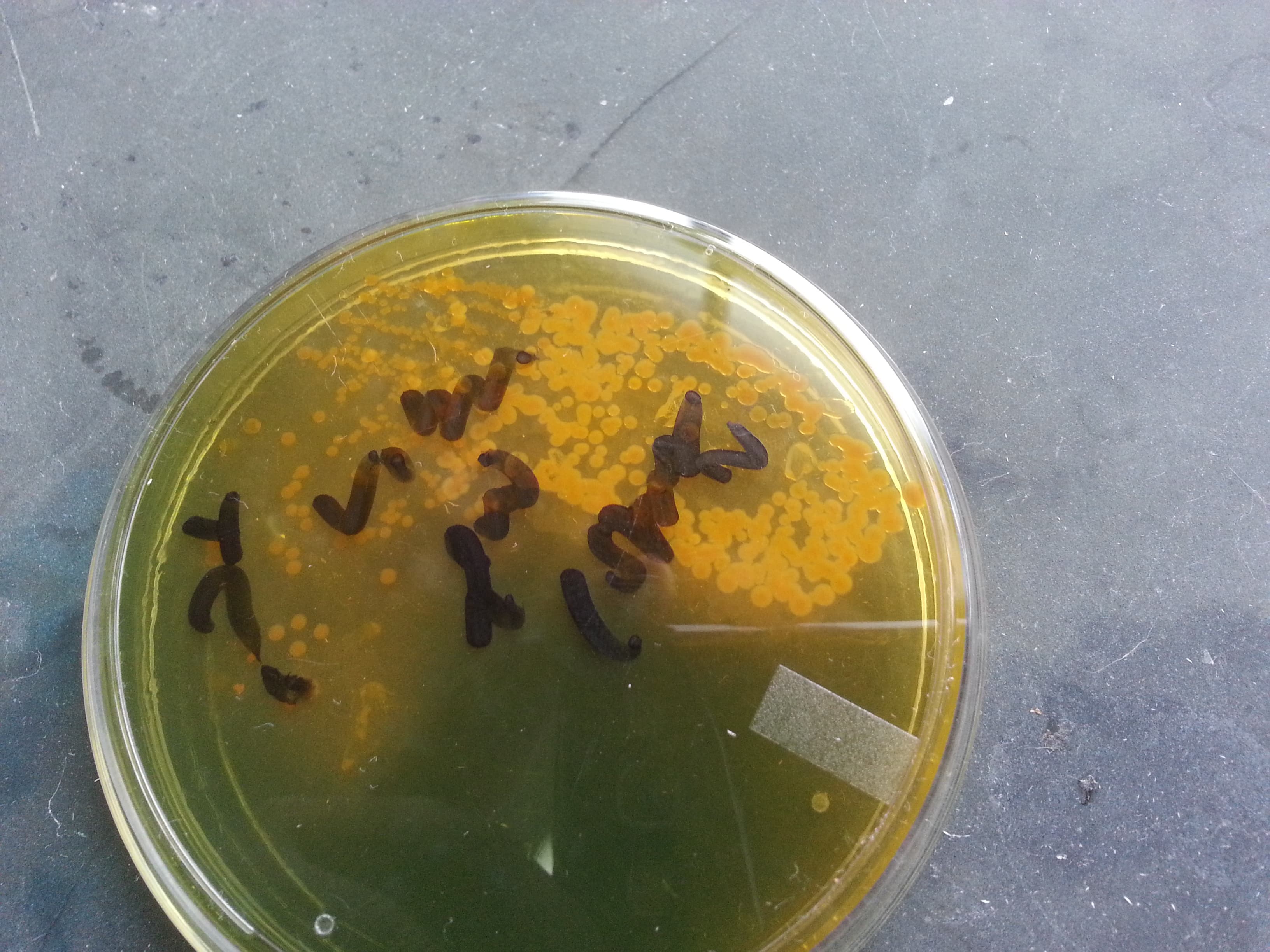 Жёлтые колонии Vibrio cholerae на чашке с TCBS-агаром