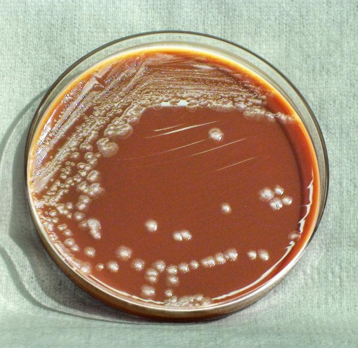 Колонии Yersinia pestis на питательном агаре