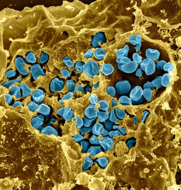 Сканирующая электронная микрофотография: синие бактерии Francisella tularensis внутри разрушенного макрофага.