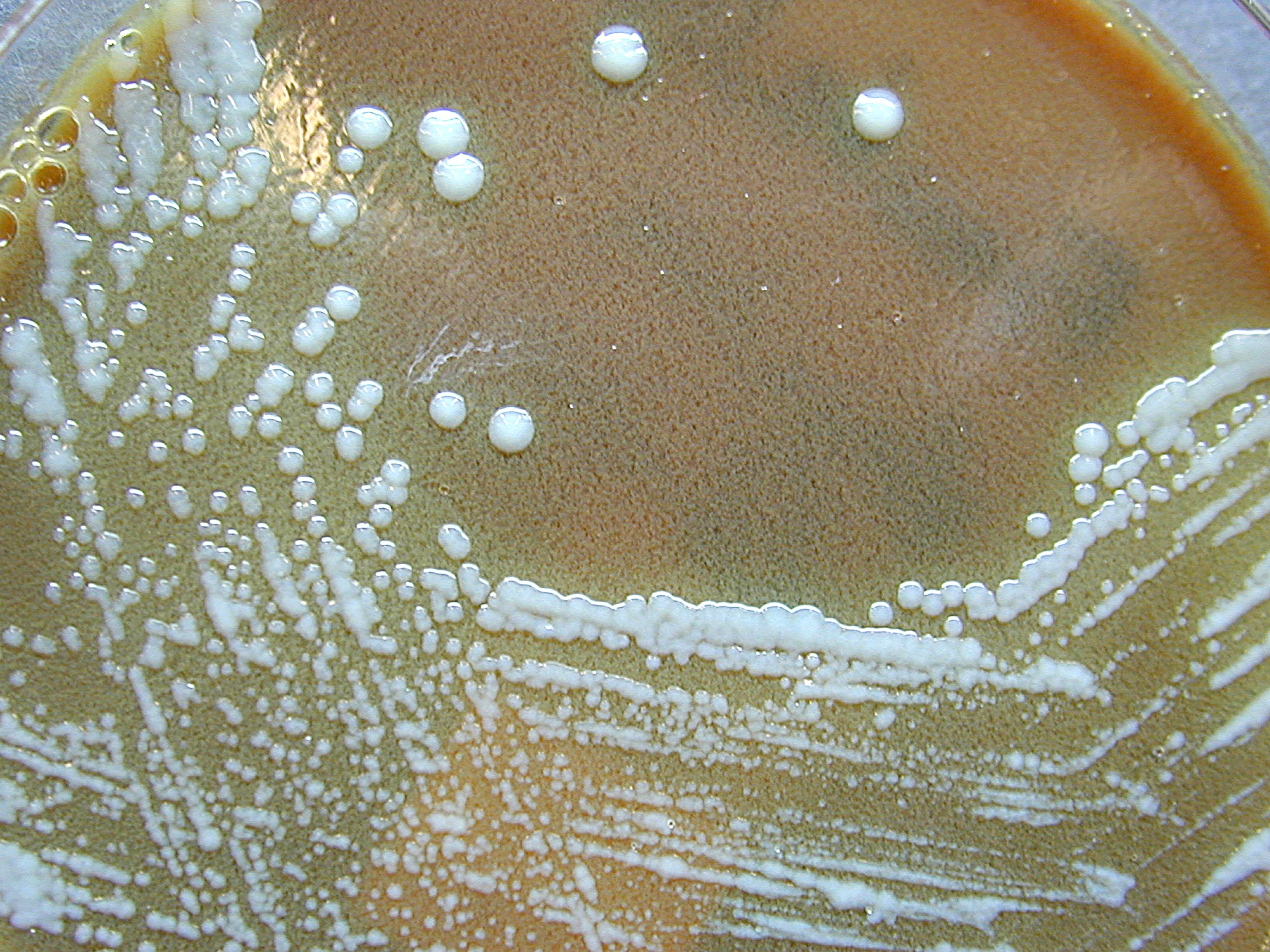 Чашка с агаром: мелкие белёсые колонии Francisella tularensis после посева.