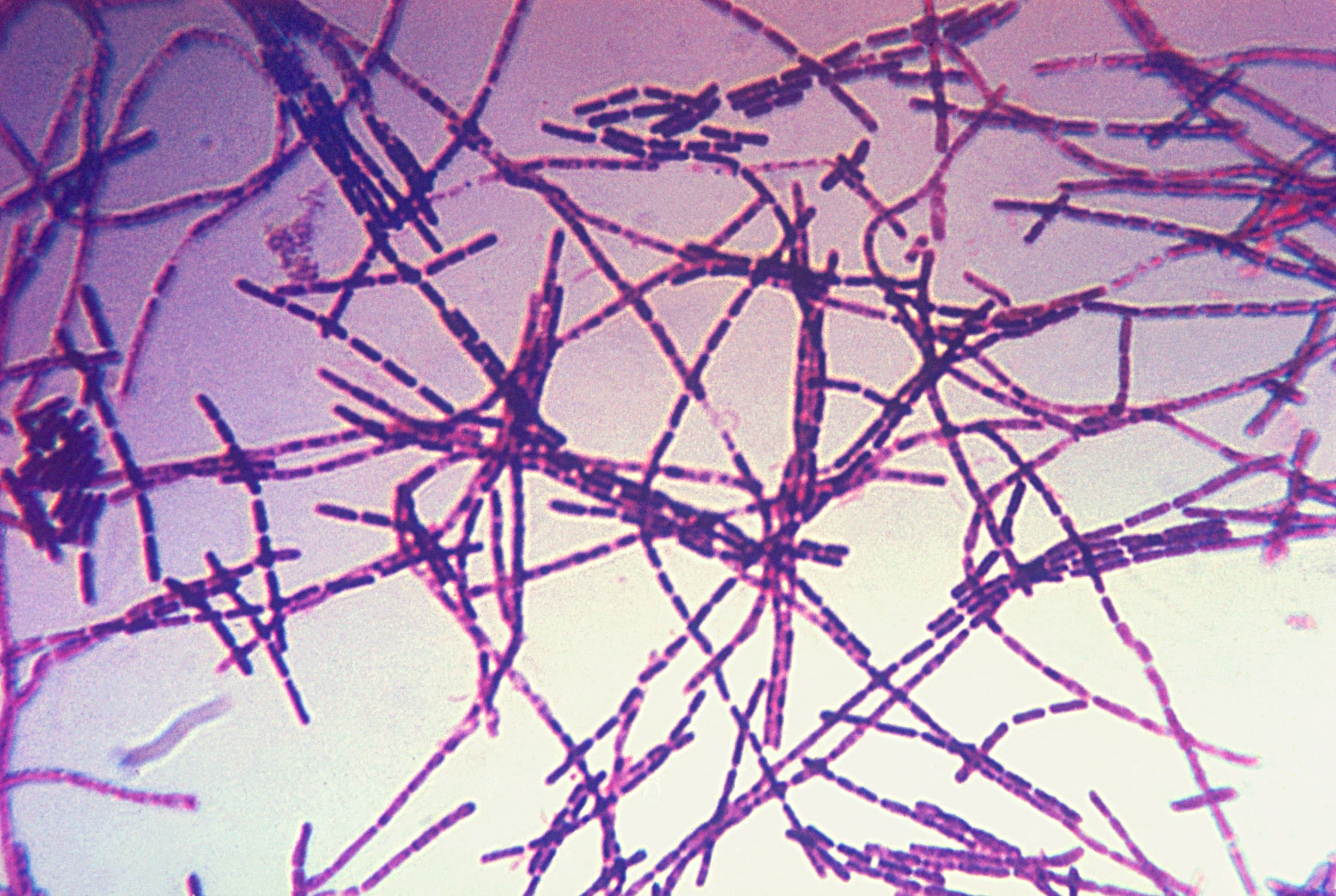 Окраска по Граму: грамположительные стрептобациллы Bacillus anthracis