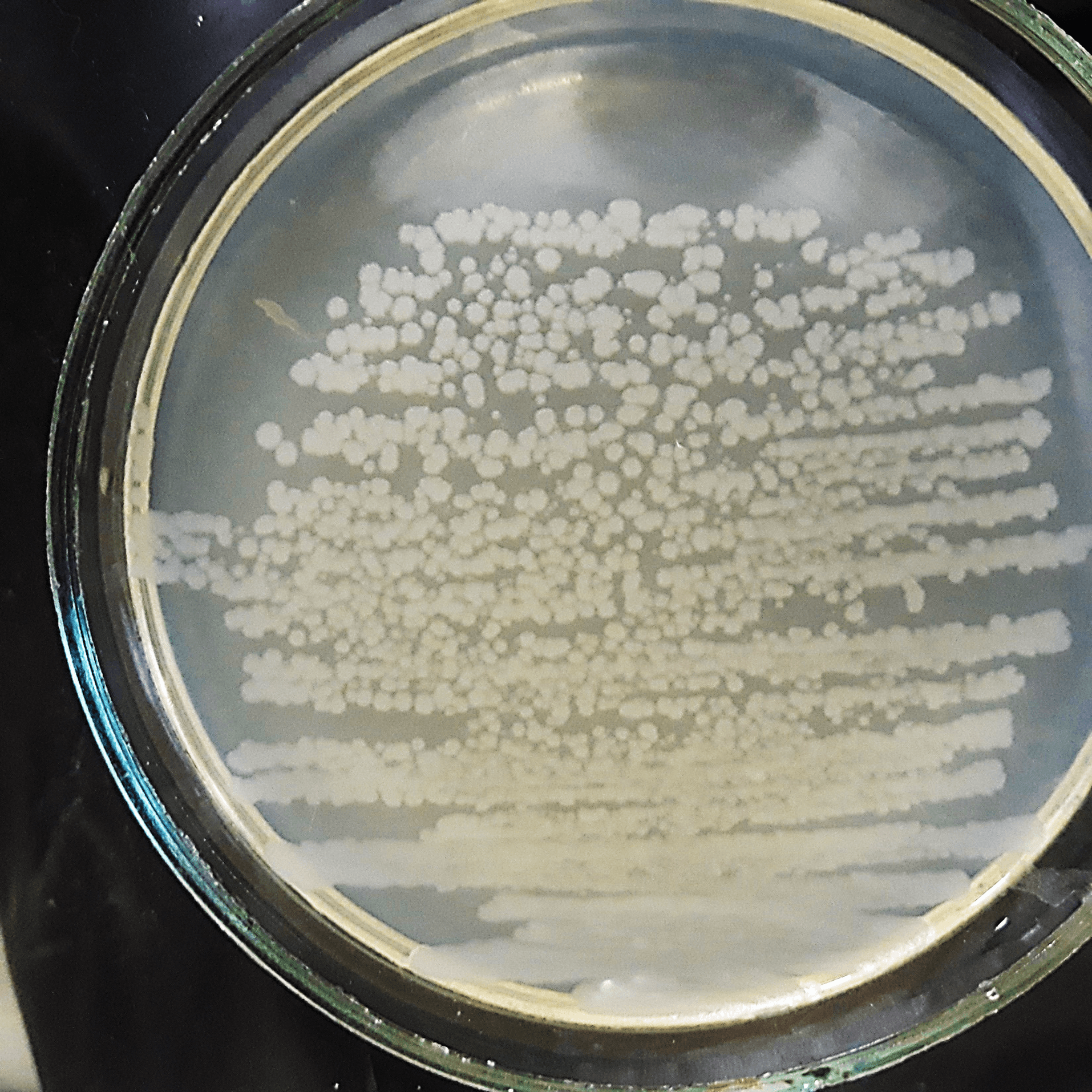 Колонии Bacillus anthracis на мясо-пептонном агаре в чашке Петри