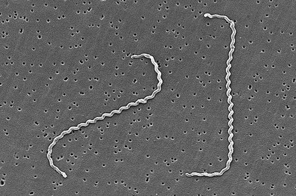 Спиралевидная спирохета Leptospira interrogans с крючковидными концами на электронной микрофотографии