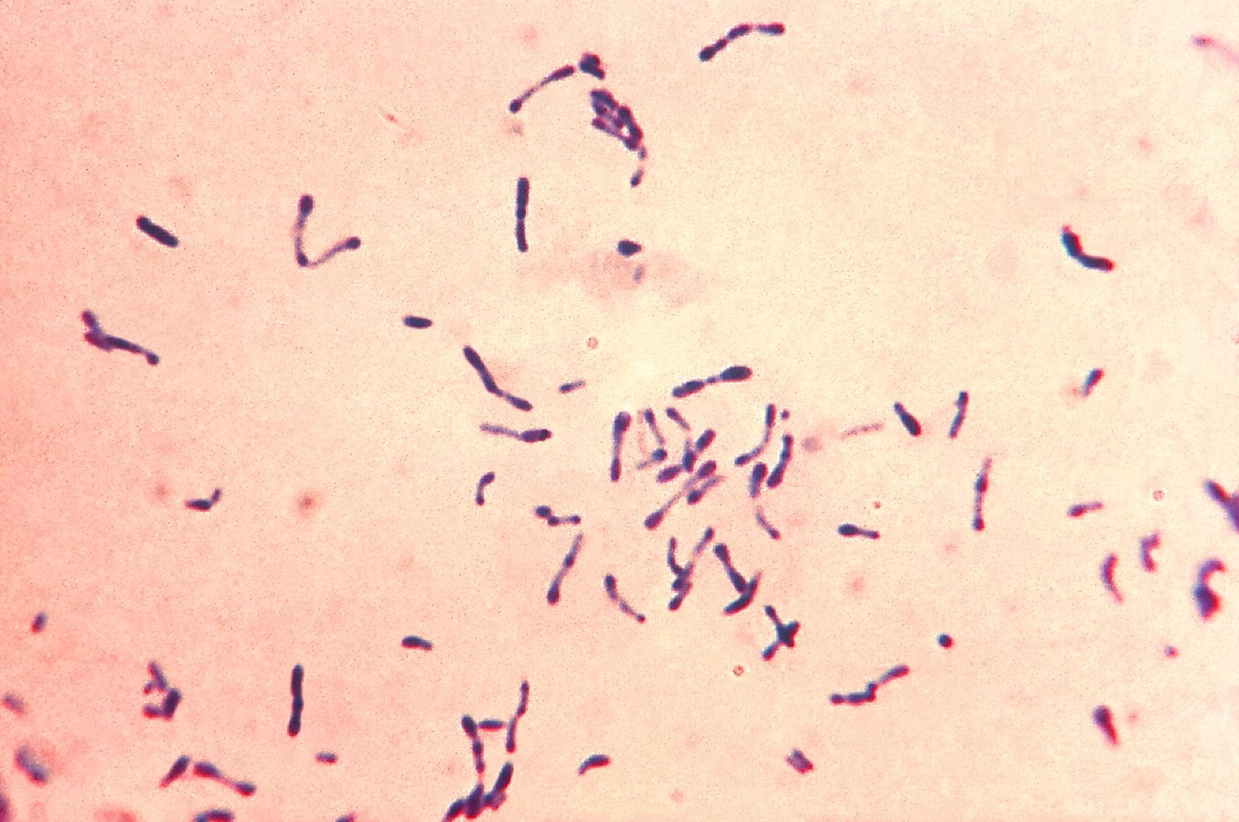 Микроскопия мазка с грамположительными палочками Corynebacterium diphtheriae