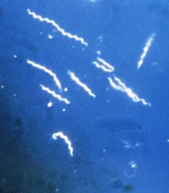 Темнопольная микрофотография спиралевидных спирохет Borrelia burgdorferi