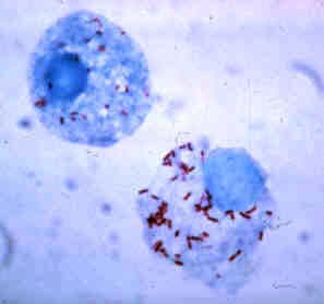 Микроскопия с окраской по Хименесу клеток клеща, инфицированных Rickettsia rickettsii