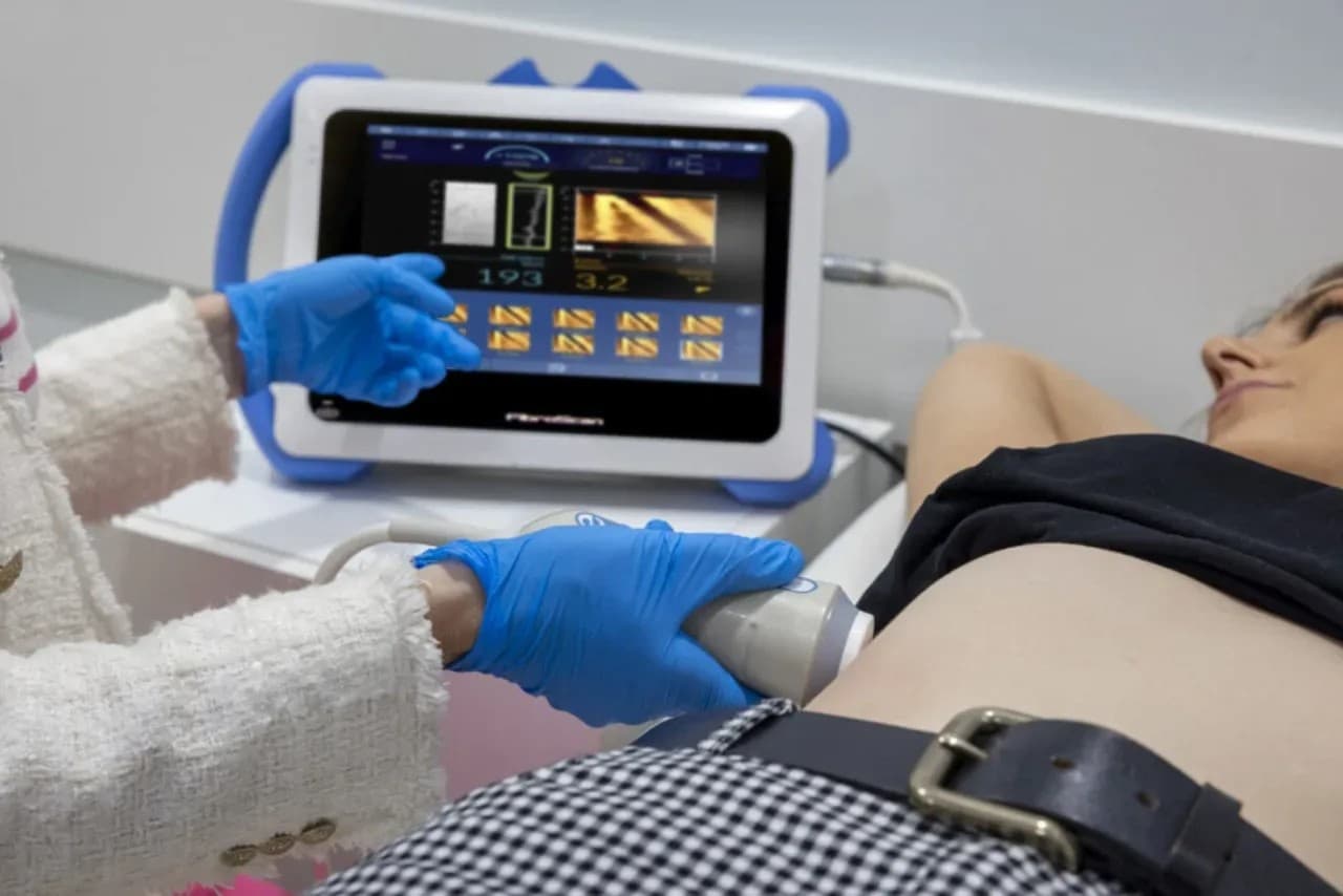 Экран FibroScan с результатами транзиентной эластографии печени