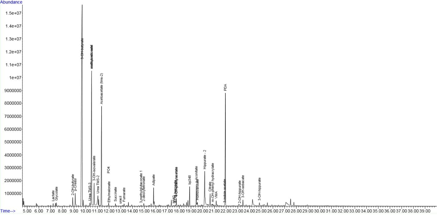 Cromatograma com picos de metabólitos separados por tempo de retenção.