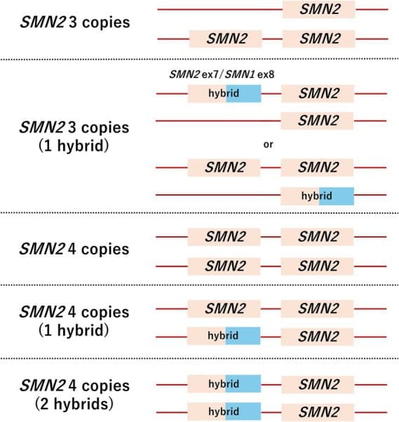 Diagrama comparando cinco arranjos genômicos do gene SMN2.