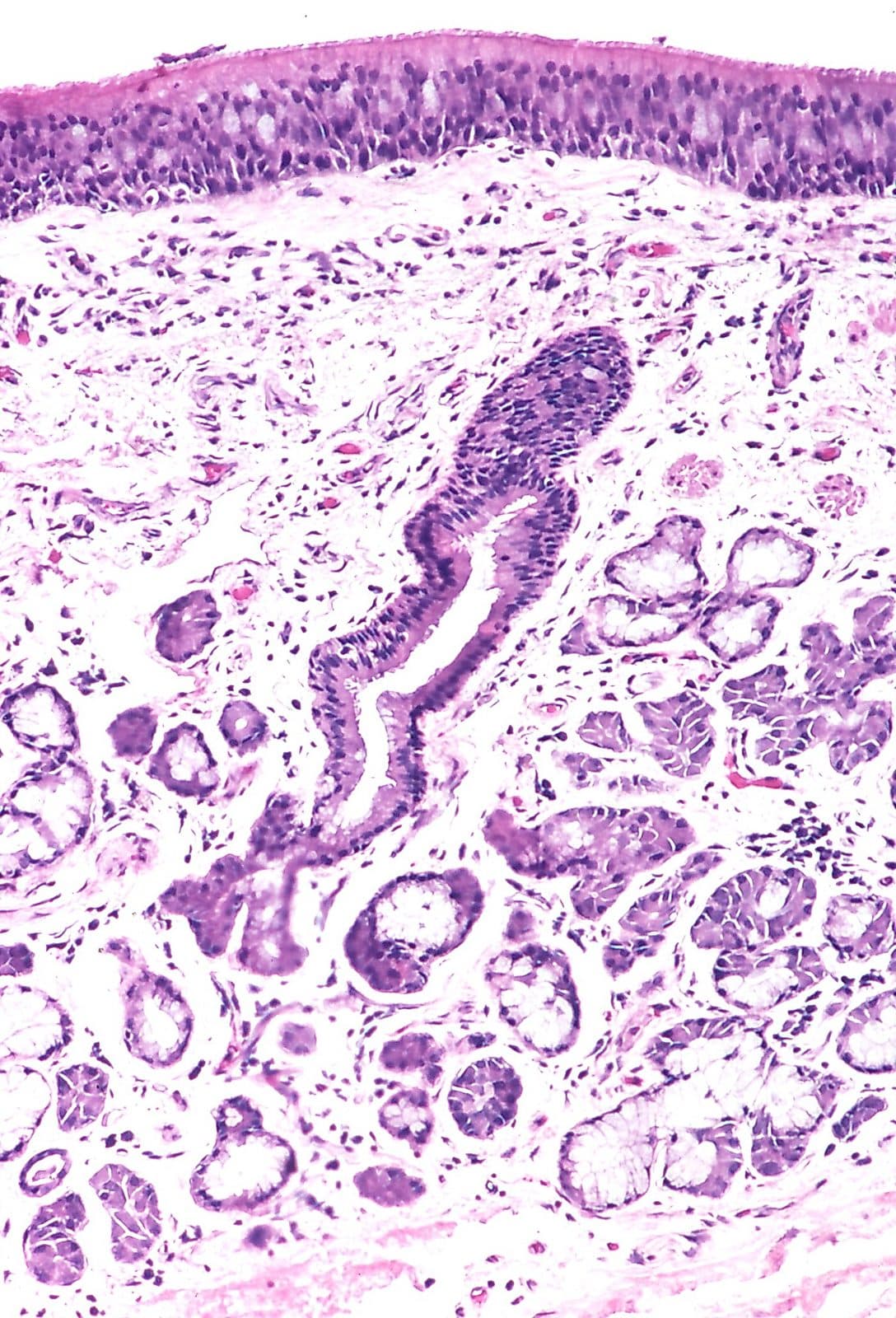 Corte histológico de brônquio com glândulas submucosas e epitélio ciliado.