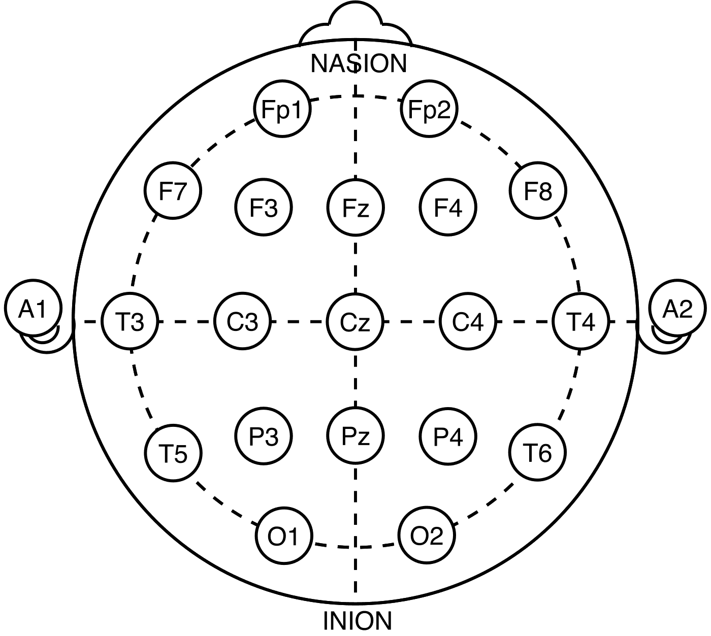 Diagrama do crânio com as posições padronizadas dos eletrodos de eletroencefalograma.