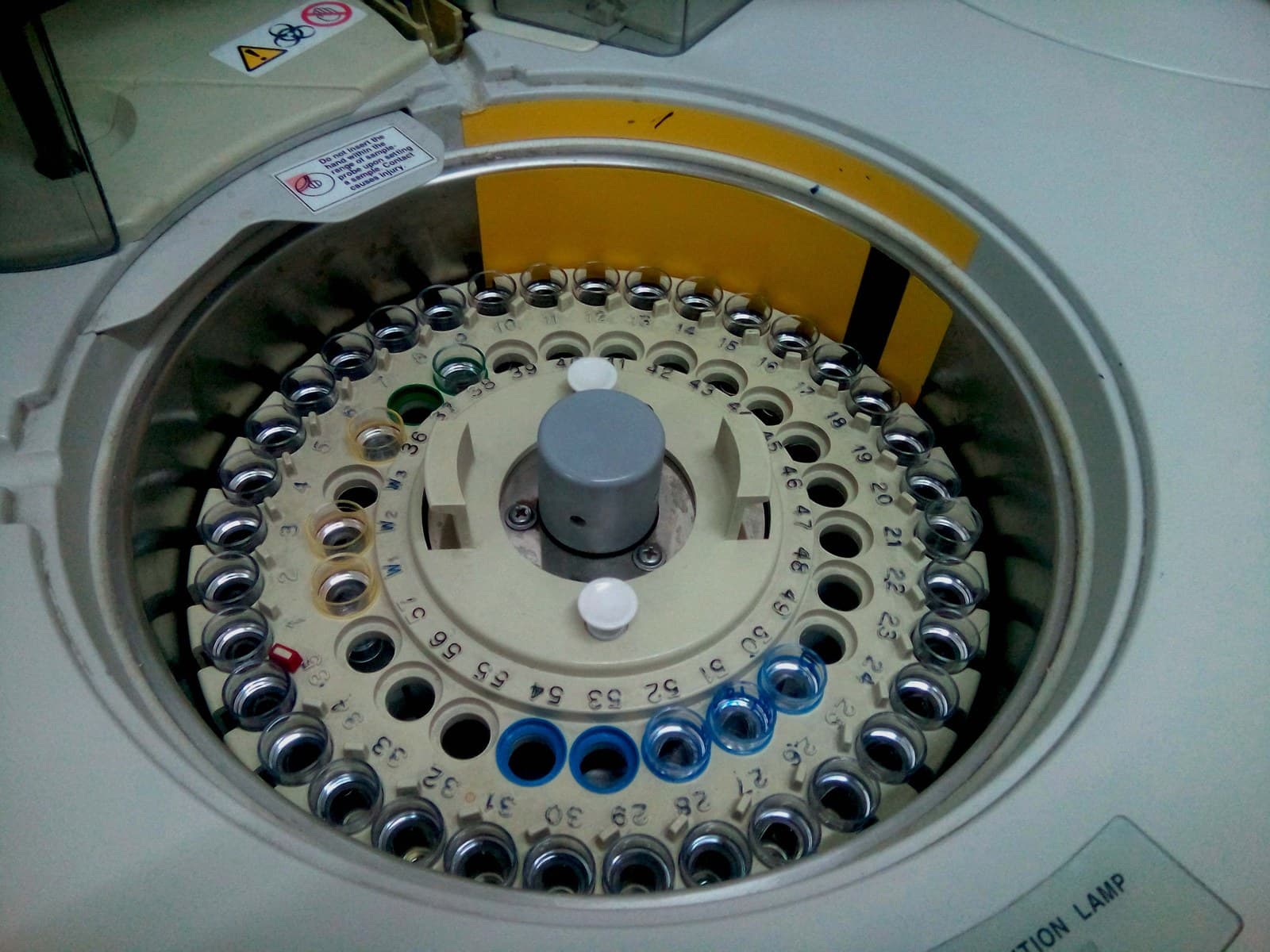 Equipamento automatizado de bioquímica clínica em laboratório.