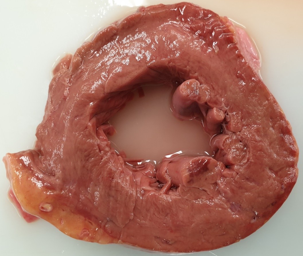 Corte transversal de corazón en pieza de patología sobre fondo blanco, que muestra la pared muscular del ventrículo y los músculos papilares