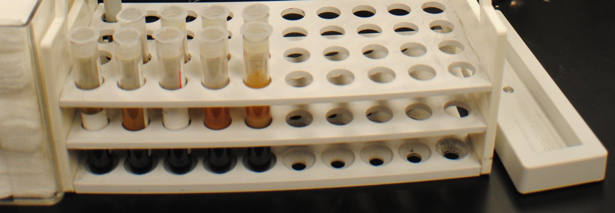 Estante de laboratório com tubos de coleta de sangue enfileirados, prontos para análise