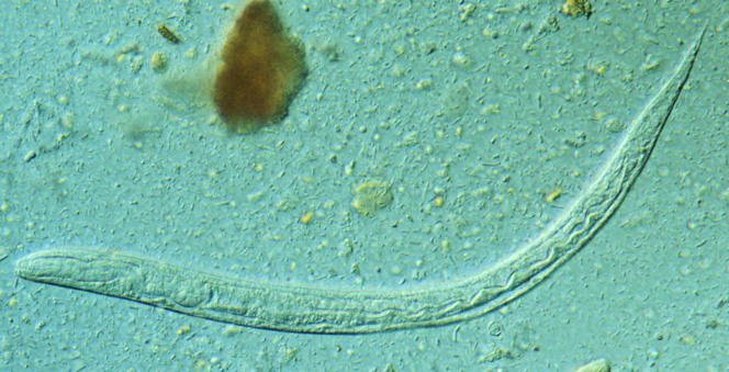 Larva de Strongyloides stercoralis vista ao microscópio