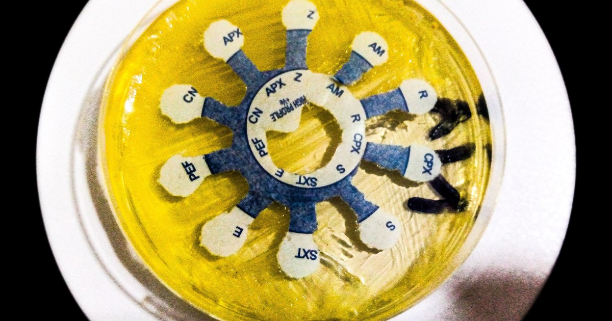 Placa de antibiograma com discos de antibiótico sobre ágar em laboratório de microbiologia