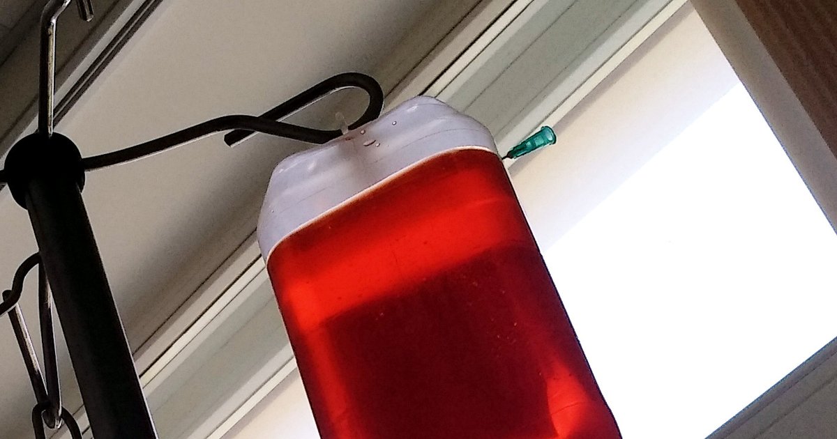Bolsa de soro com líquido vermelho pendurada em suporte de infusão, com equipo transparente descendo