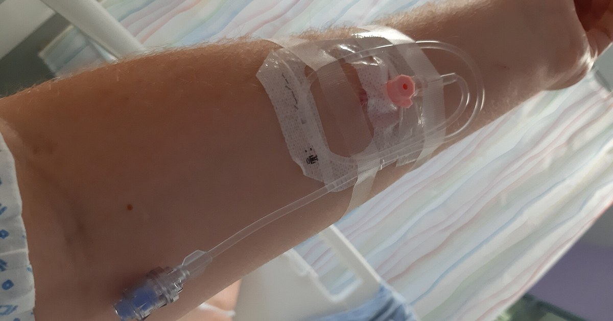 Antebraço com cateter venoso periférico fixado por curativo transparente e extensão de soro, sobre lençol listrado de hospital