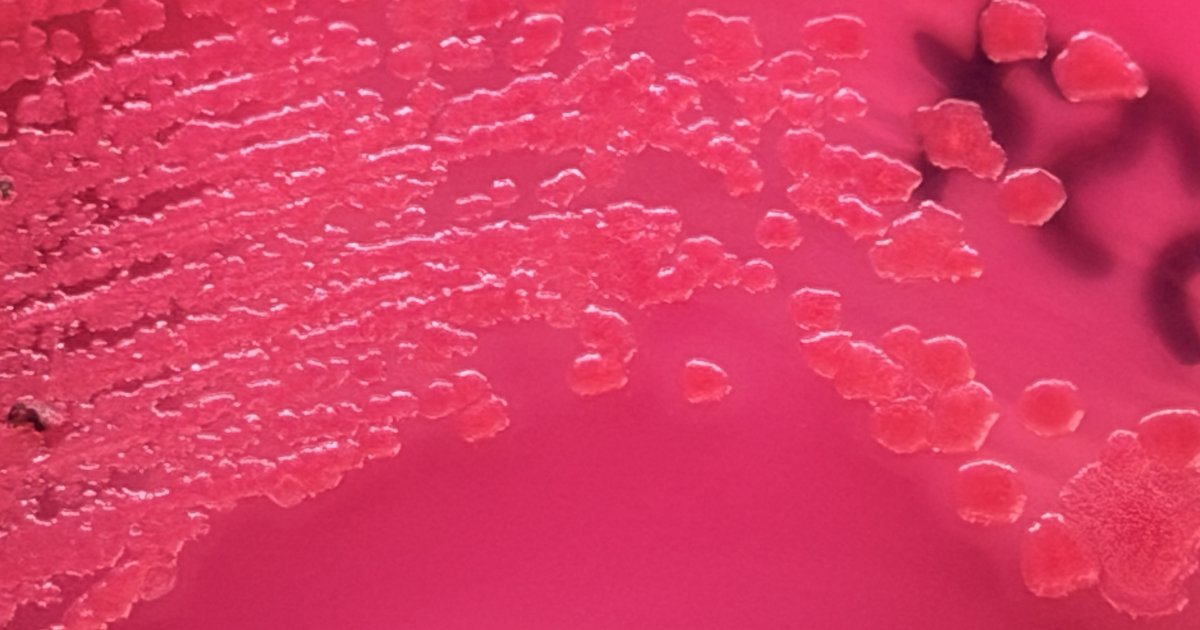 Colônias bacterianas rosadas e brilhantes espalhadas sobre placa de ágar de cor rosa intensa