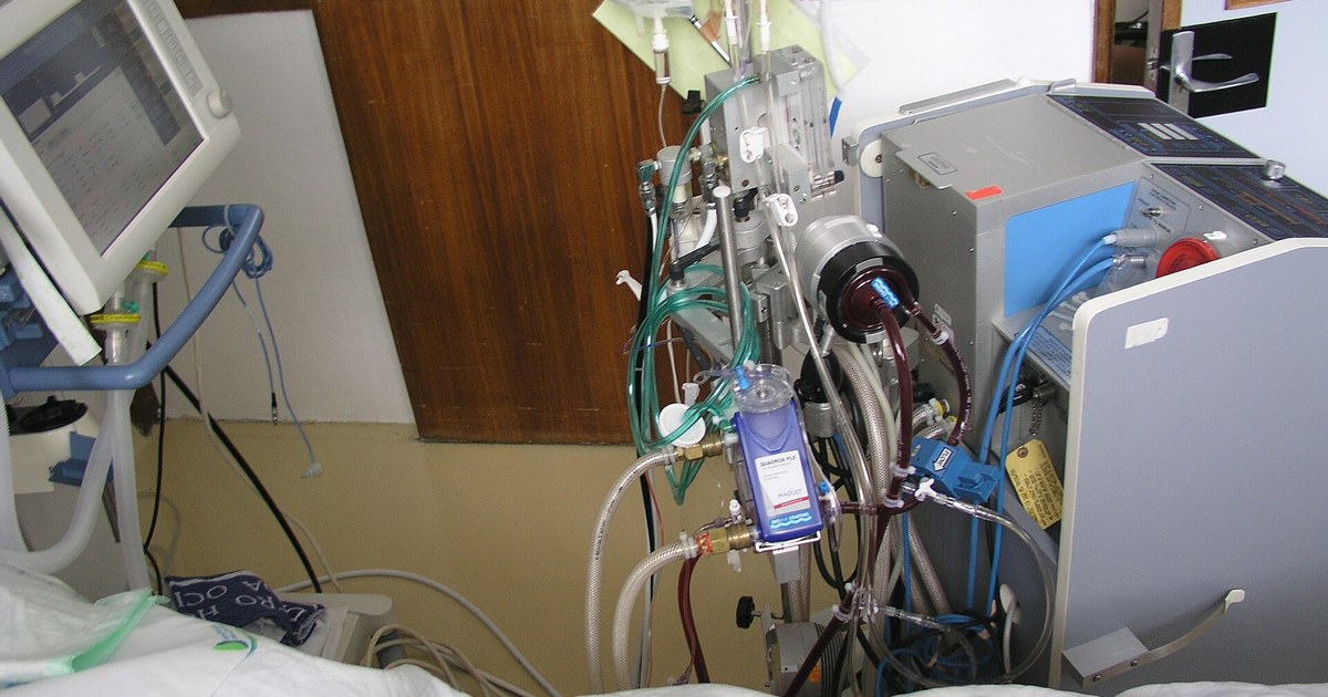 Consola de circulación extracorpórea con tubos y oxigenador junto a una cama de cuidados intensivos