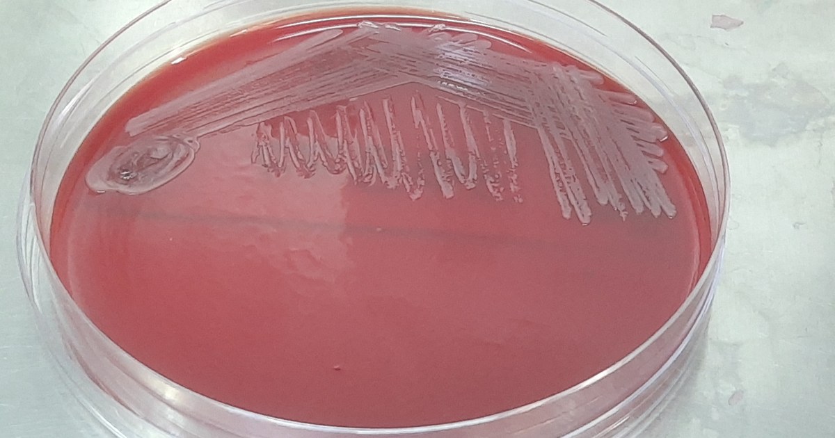 Placa de Petri com ágar-sangue vermelho e colônias bacterianas semeadas em estrias a partir de hemocultura