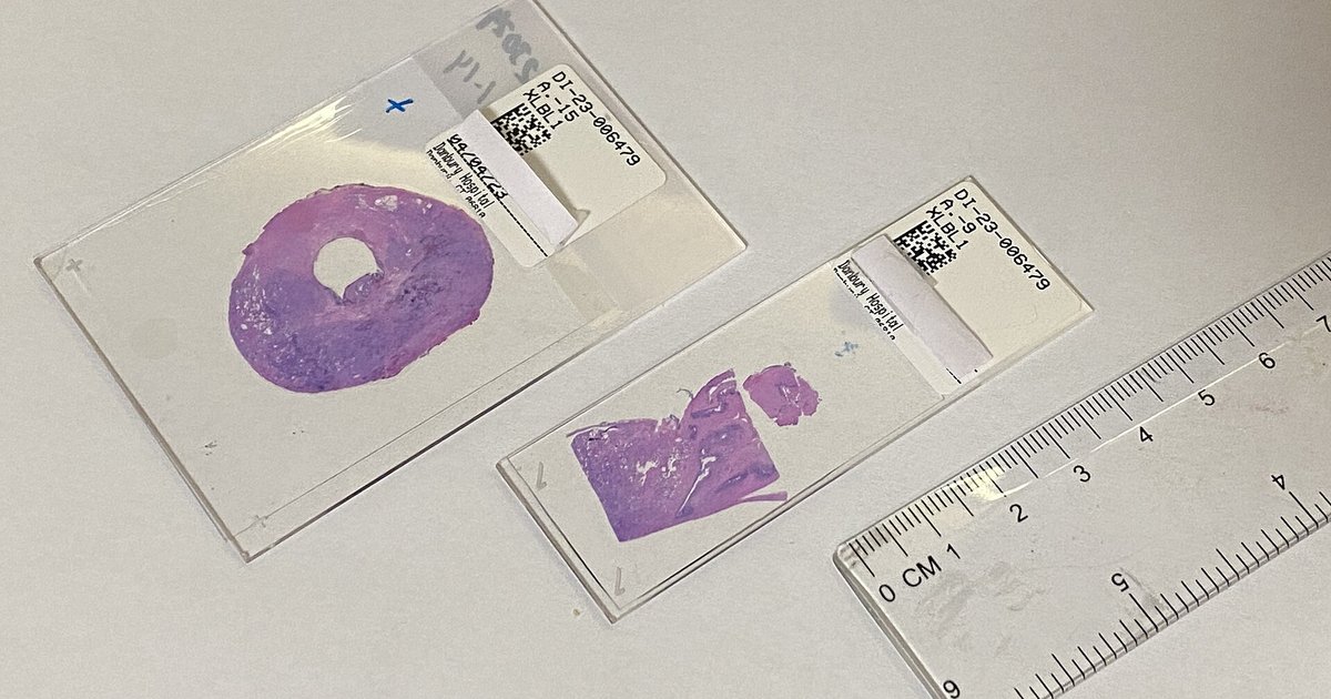 Microscope slides of two sizes
