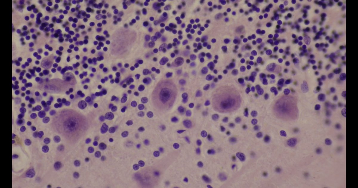 Células de Purkinje coradas ao microscópio