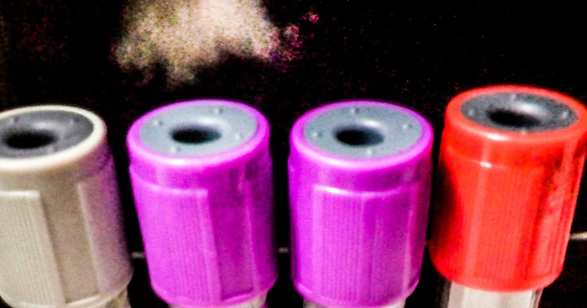 Tampas coloridas de quatro tubos de coleta de sangue, cinza, roxas e vermelha, em fundo escuro