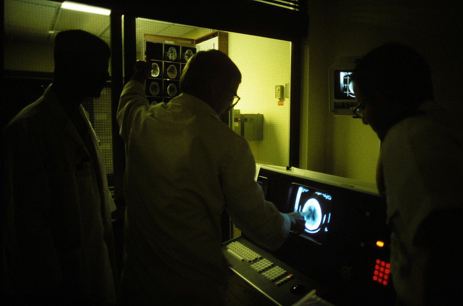 Neurosurgery team in lab coats in a dark room, facing a monitor with a skull CT scan and a light box with imaging films.