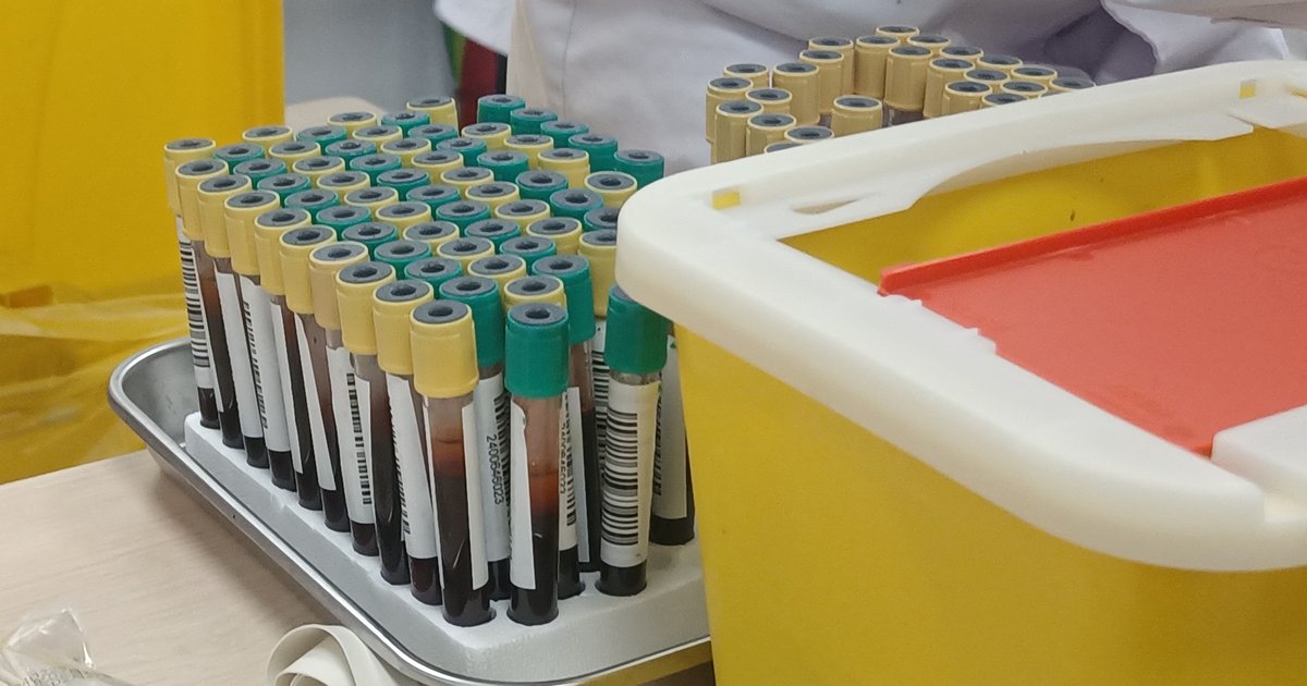 Estante metálica com dezenas de tubos de coleta de sangue com tampas amarelas e verdes, ao lado de uma caixa amarela