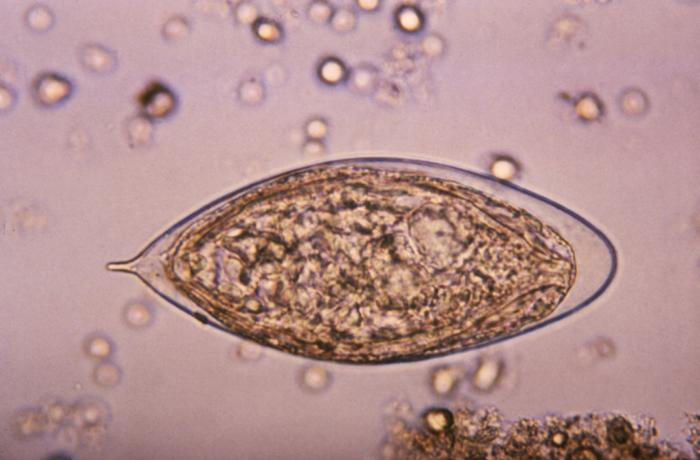 Ovo de Schistosoma haematobium visto ao microscópio, com o espículo terminal característico