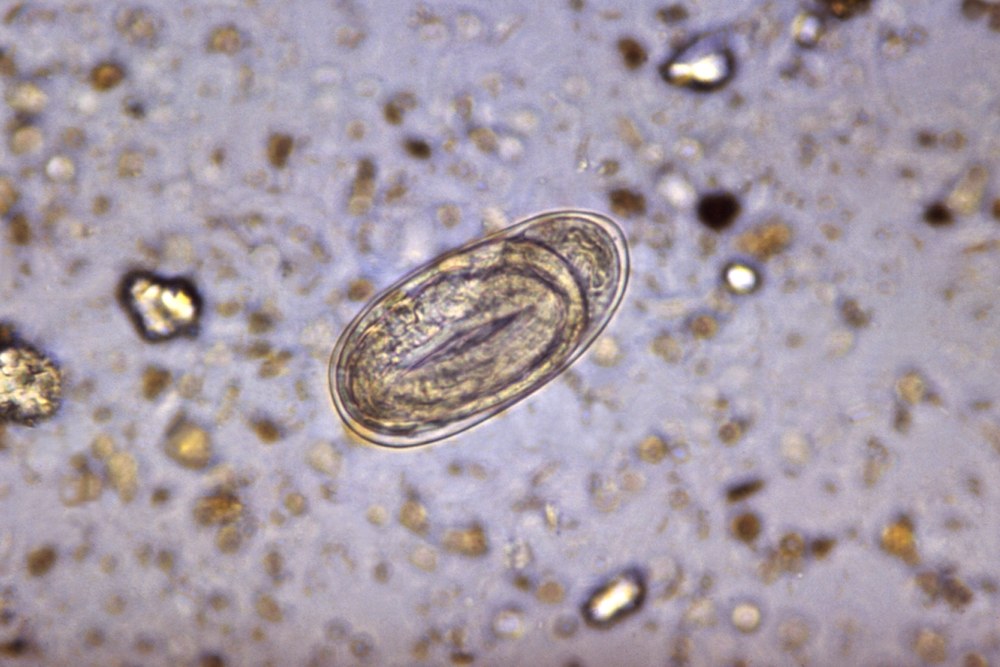 Ovo de ancilostomídeo visto ao microscópio em amostra de fezes