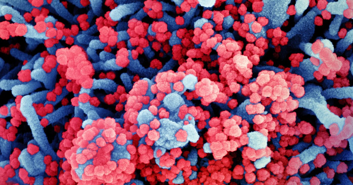 Micrografia eletrônica colorida de uma célula azul coberta por numerosas partículas virais vermelhas